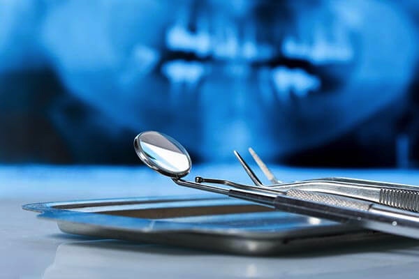 Zabiegi chirurgii stomatologicznej – precyzyjnie, profesjonalnie, bezpiecznie