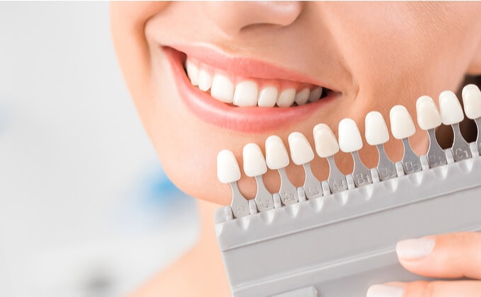 Wybielanie zębów – w domu czy u dentysty?