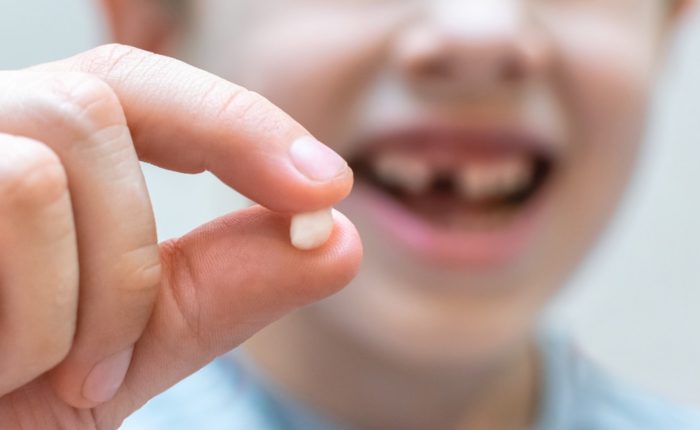 Próchnica zębów mlecznych – czy warto leczyć zęby małego dziecka?
